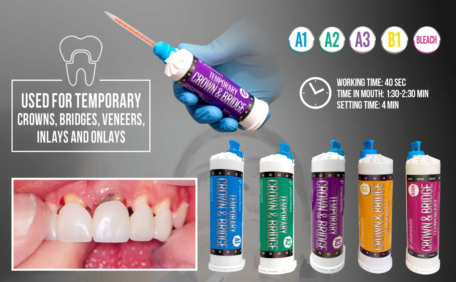 B1 Temporary Crown & Bridge Material 10:1 Dental Impression 76g (Made in GER)