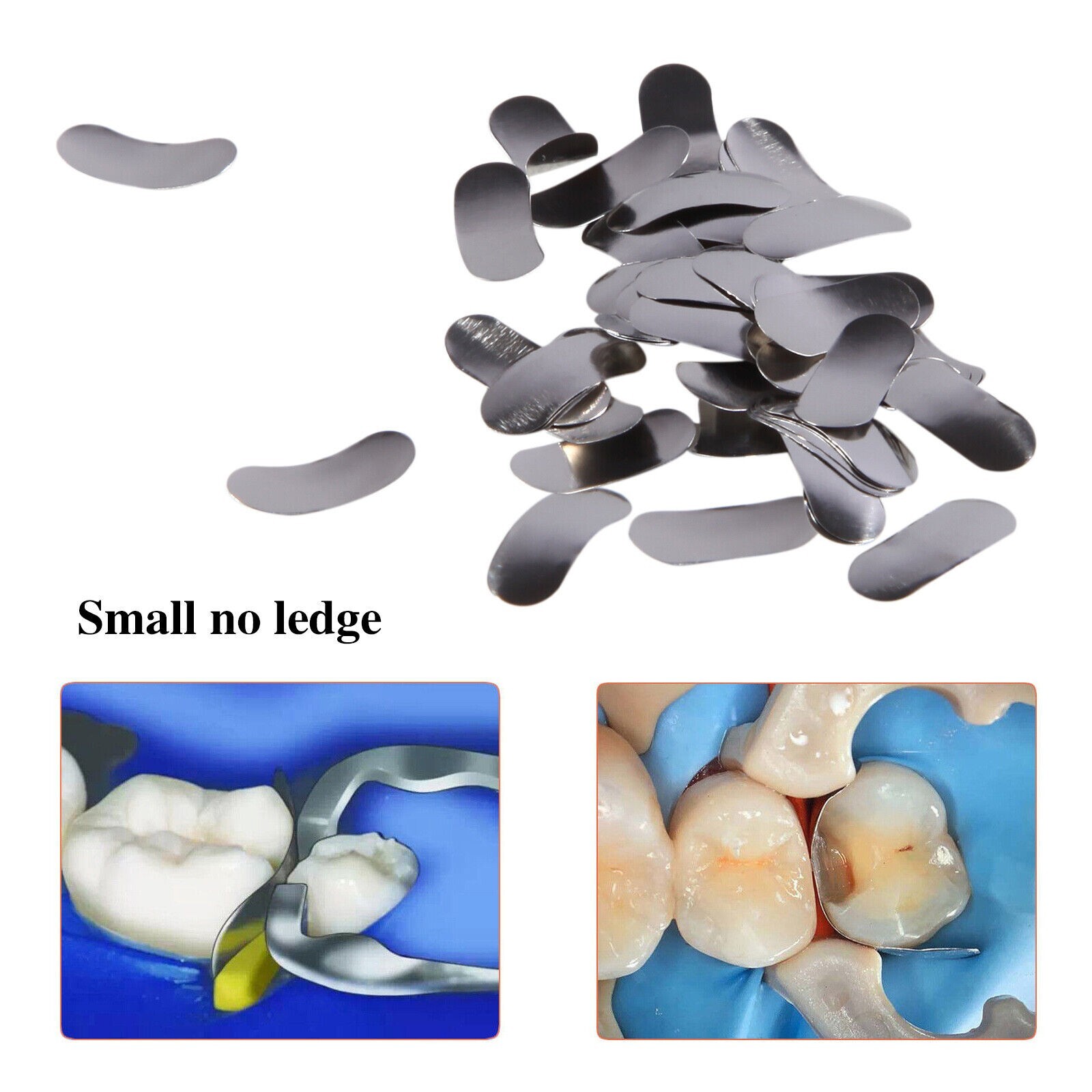 50Pcs Dental Sectional Matrix System Contoured Metal Matrices Refill Bands USA
