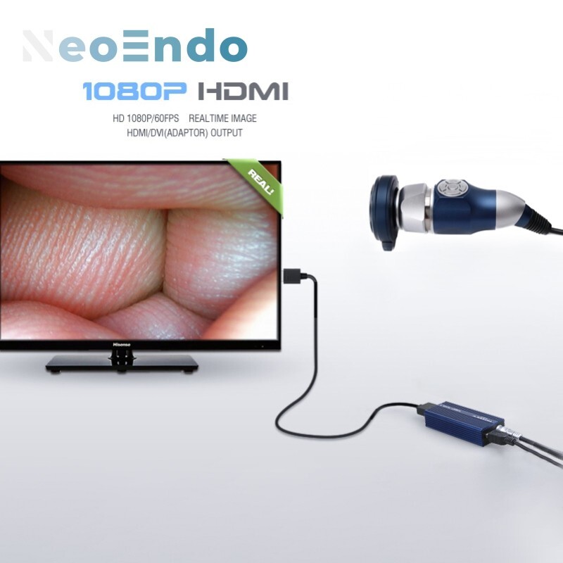 Portable Full HD 1080P Medical Endoscope Camera for ENT Surgery & Inspection