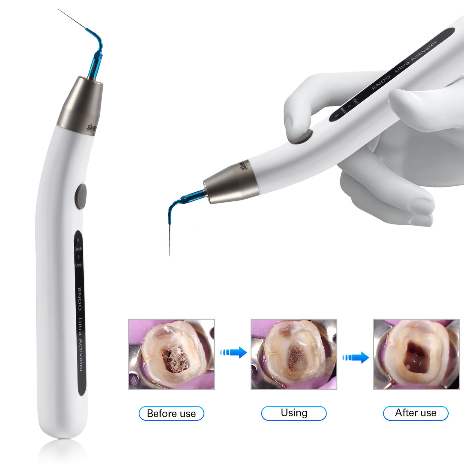 Endo Ultra Activator Dental Ultrasonic Root Canal Irrigator Handpiece 6 Tips DL