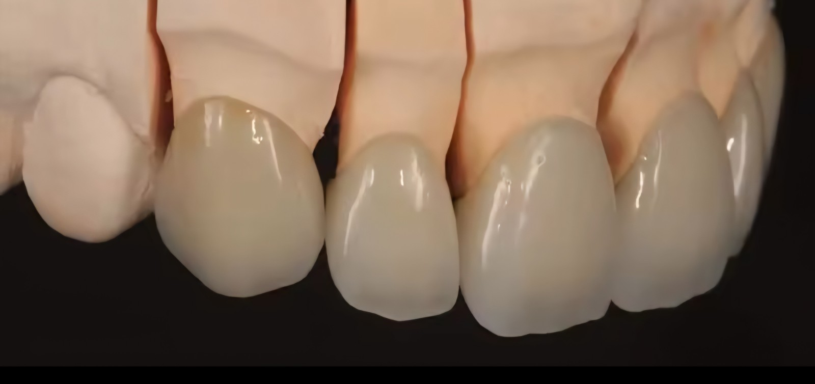 zirconia blocks dental