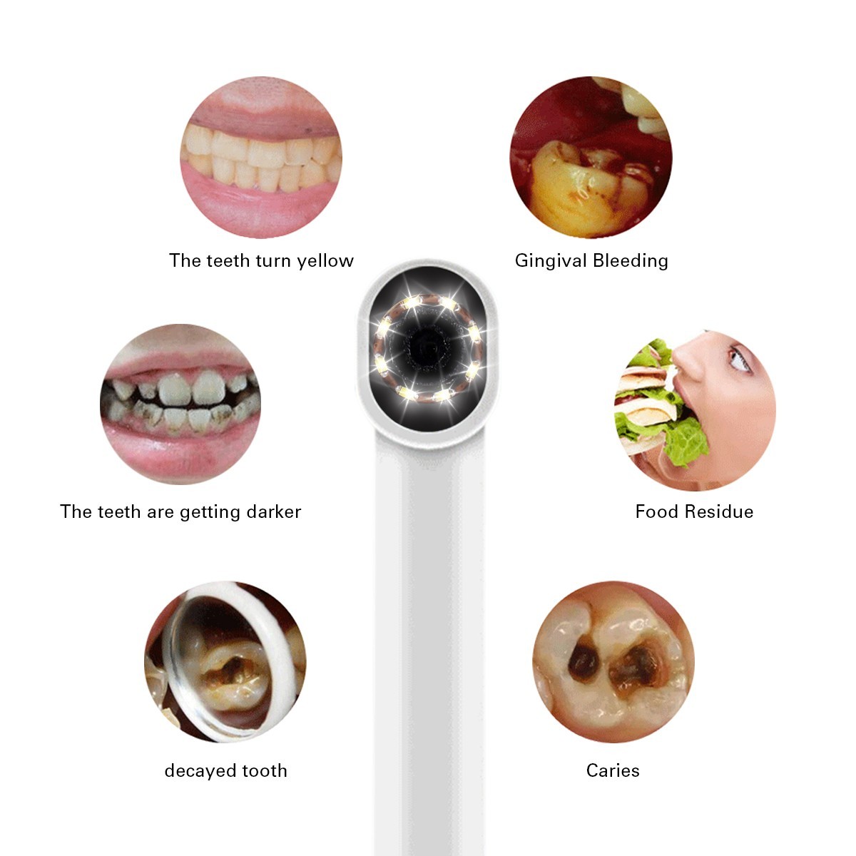 AZDENT Dental USB Imaging Intraoral Camera Real-time Video 8LED Light Endoscope