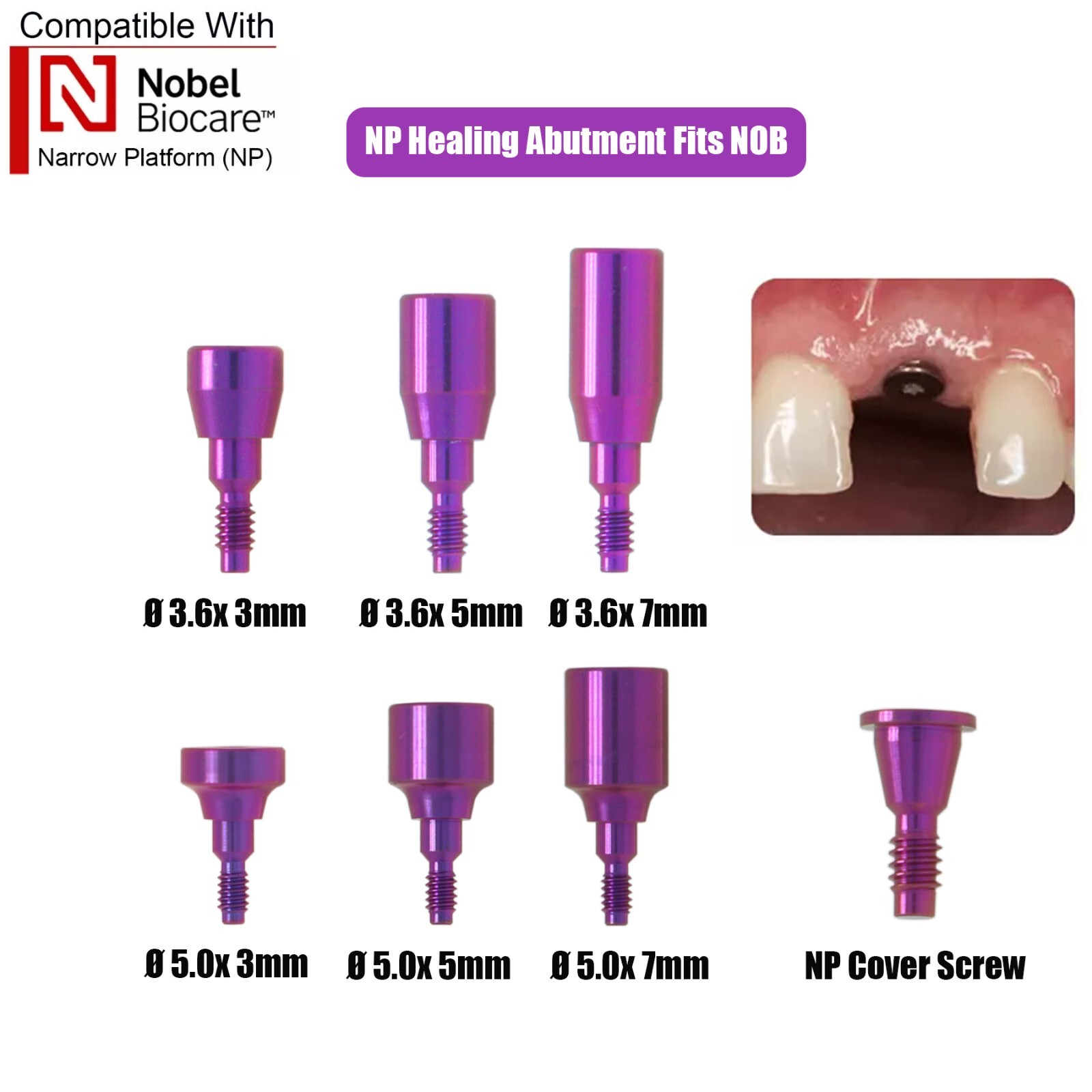 5Pcs Dental Healing Abutment Cap NP Internal conical Fits Nobel Biocare Ø3.6/5mm