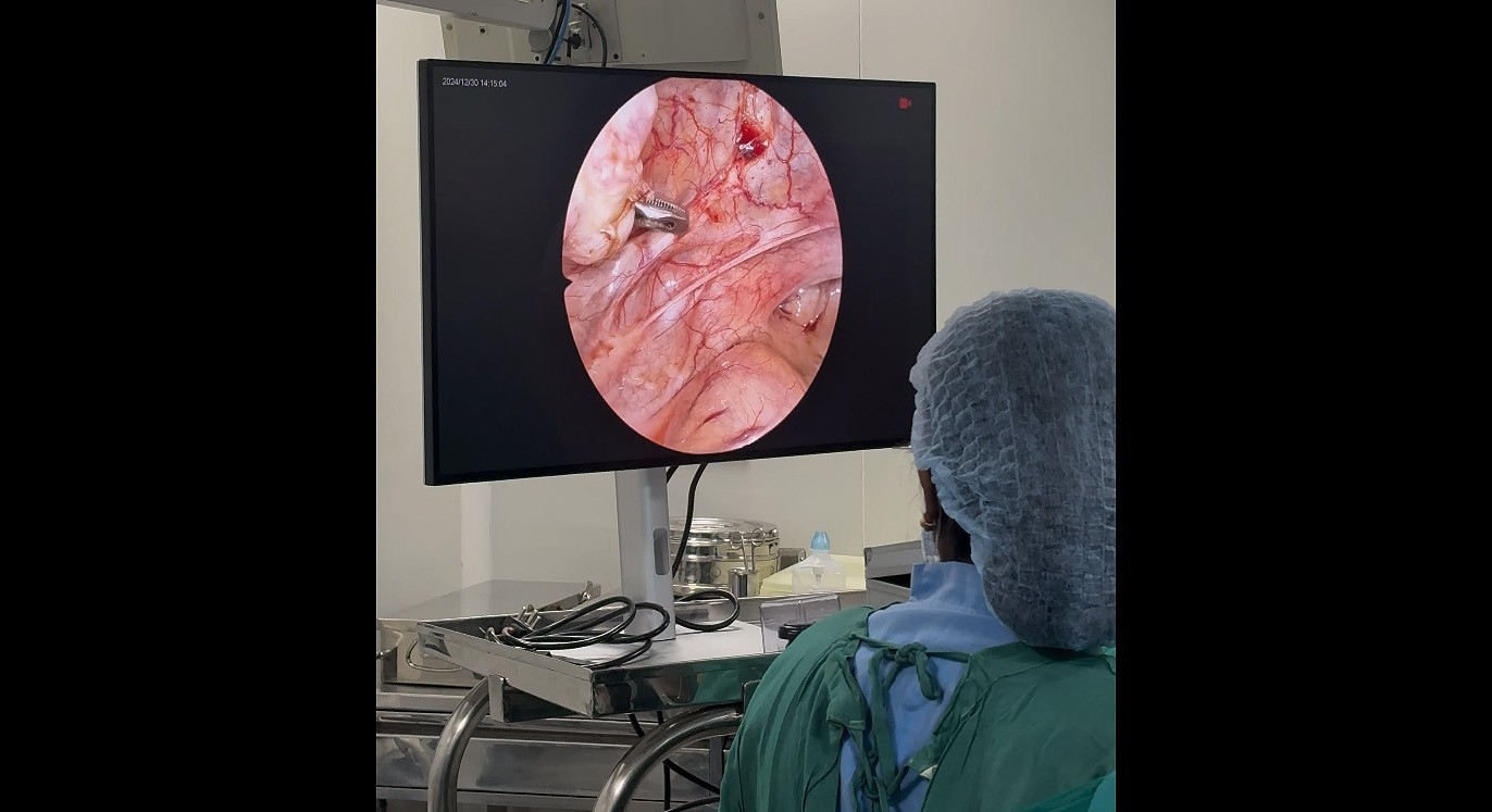 4k Endoscopy Laparoscopic Camera System UHD-LP-6000 Ultra HD Endoscope Camera