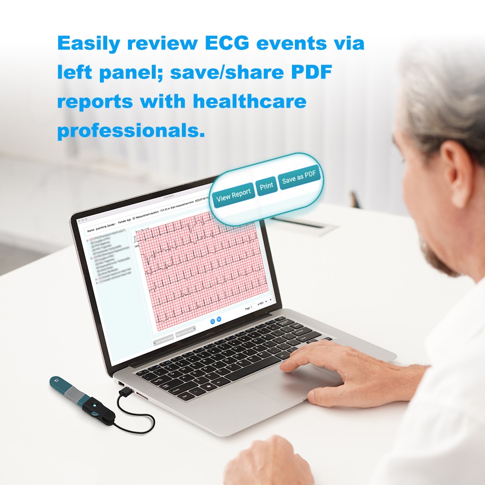 AI Holter Monitor 24 Hrs Chest Strap EKG Monitor with Free AI Analysis PC Report