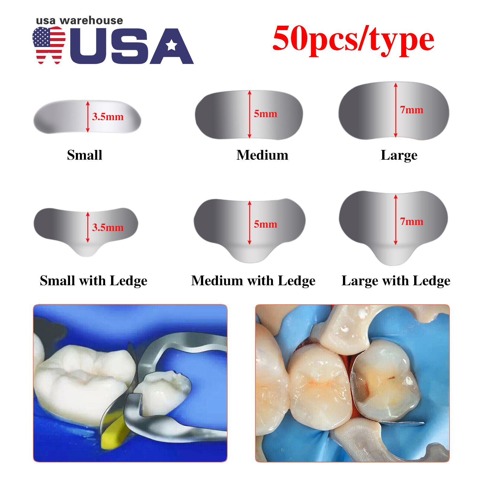 50 Pcs Dental Sectional Contoured Metal Matrices Refill Matrix Band Ledge 35μm