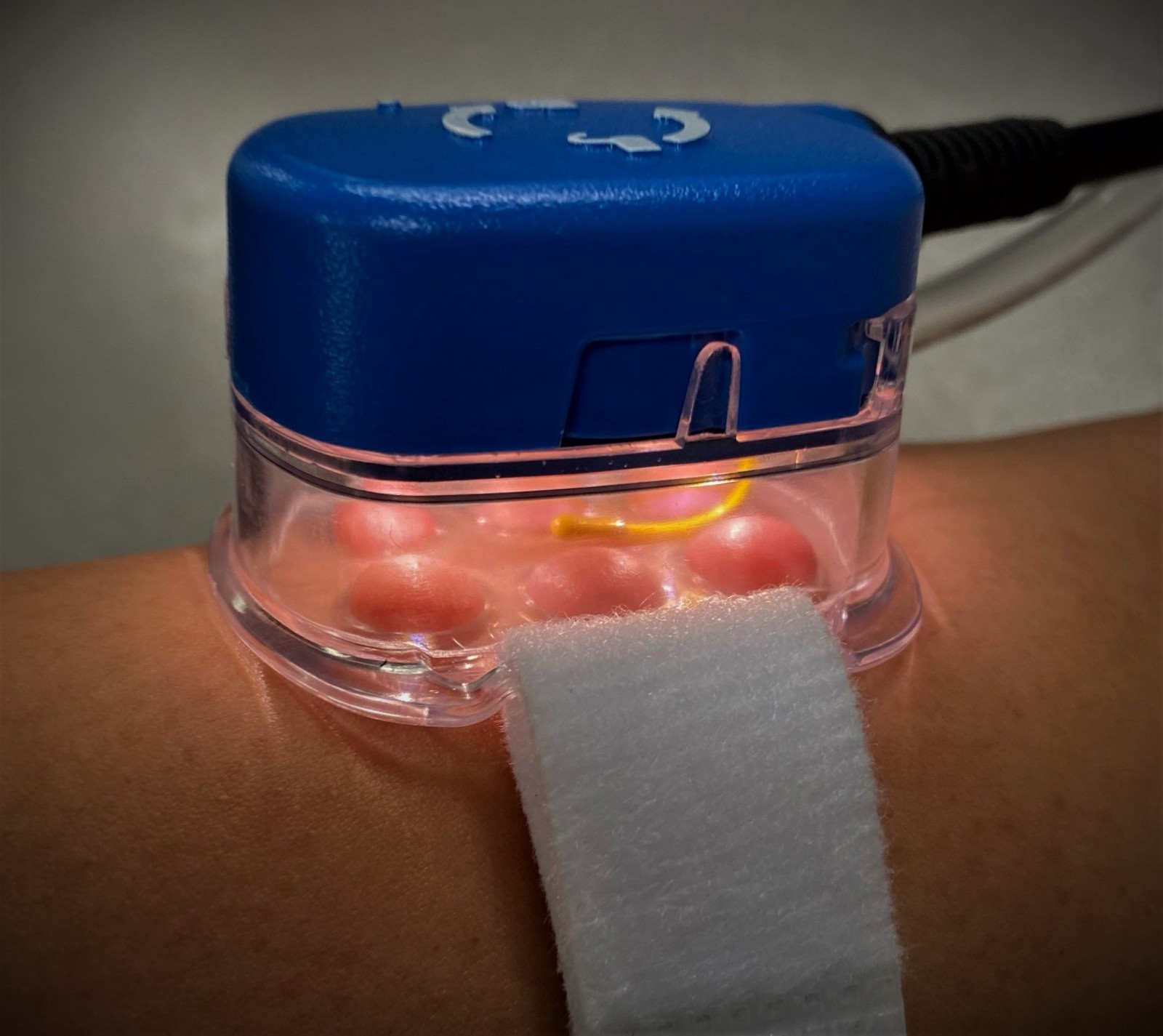 EPITECH 1002 Epidermal Harvesting System – FDA Registered