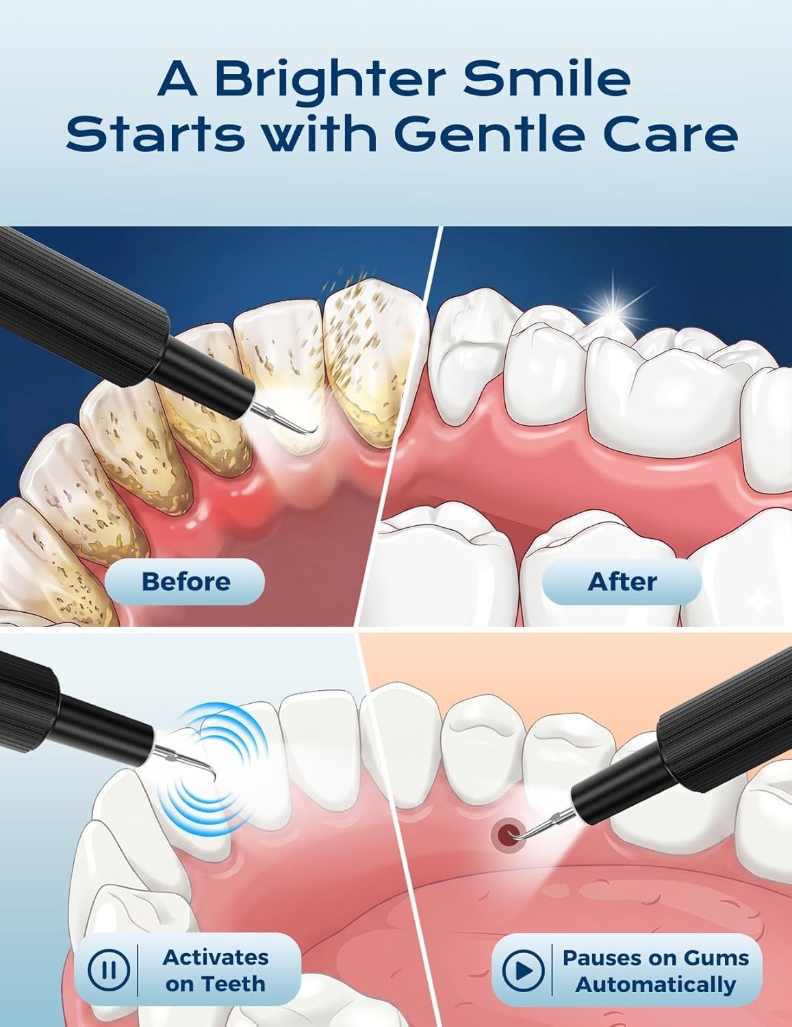 Teeth Cleaning Kit Electric Ultrasound Tartar Remover with LED Light 4 Modes