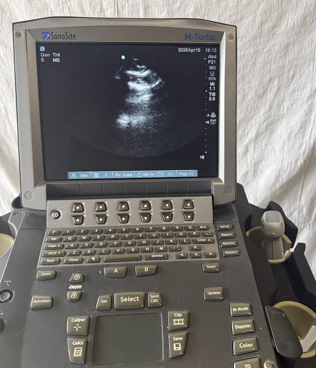 SonoSite M-Turbo Ultrasound With Cart & P21x Transducer Probe