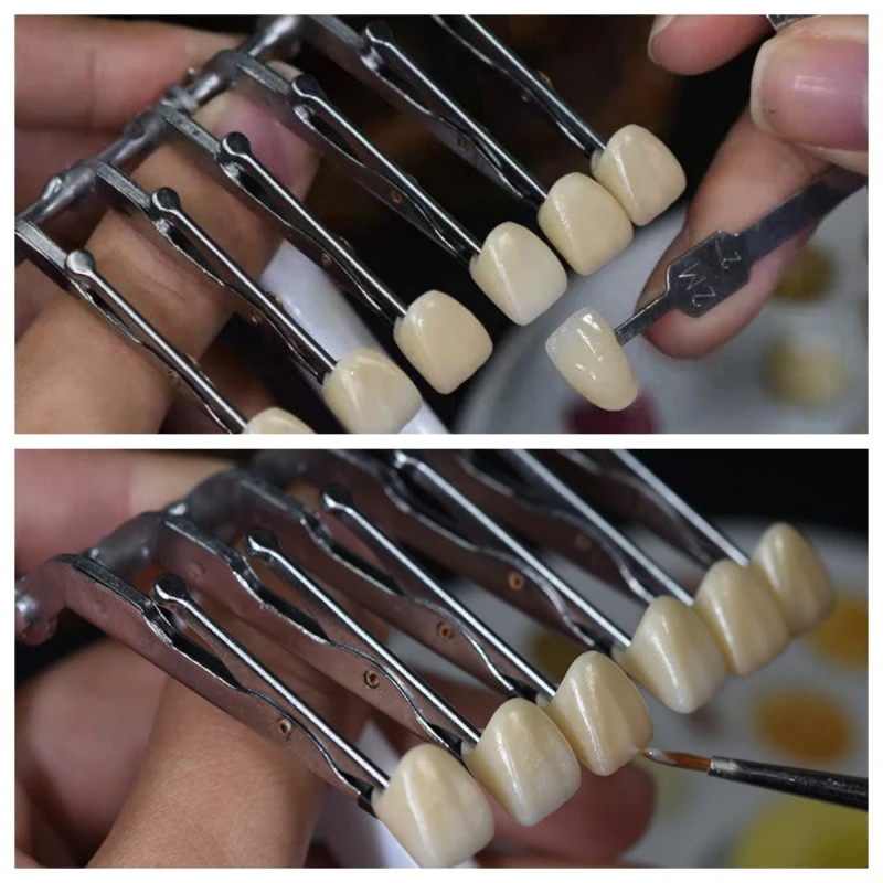 Dental Veneer Porcelain False Teeth Clip Veneer Glazing Clip Crown Holder Clamp