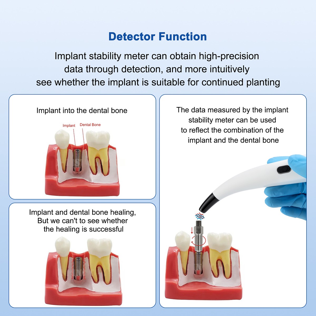 Dental Ortho Composite Ceramic Lingual Buttons for Bondable Round Base