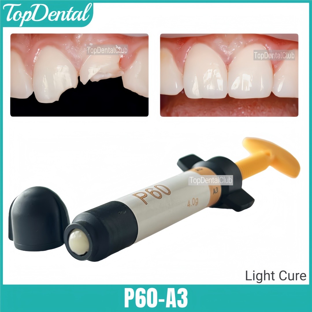P60 A3 Dental Light Cure Composite Resin Veneer Whitening Posterior Restorative