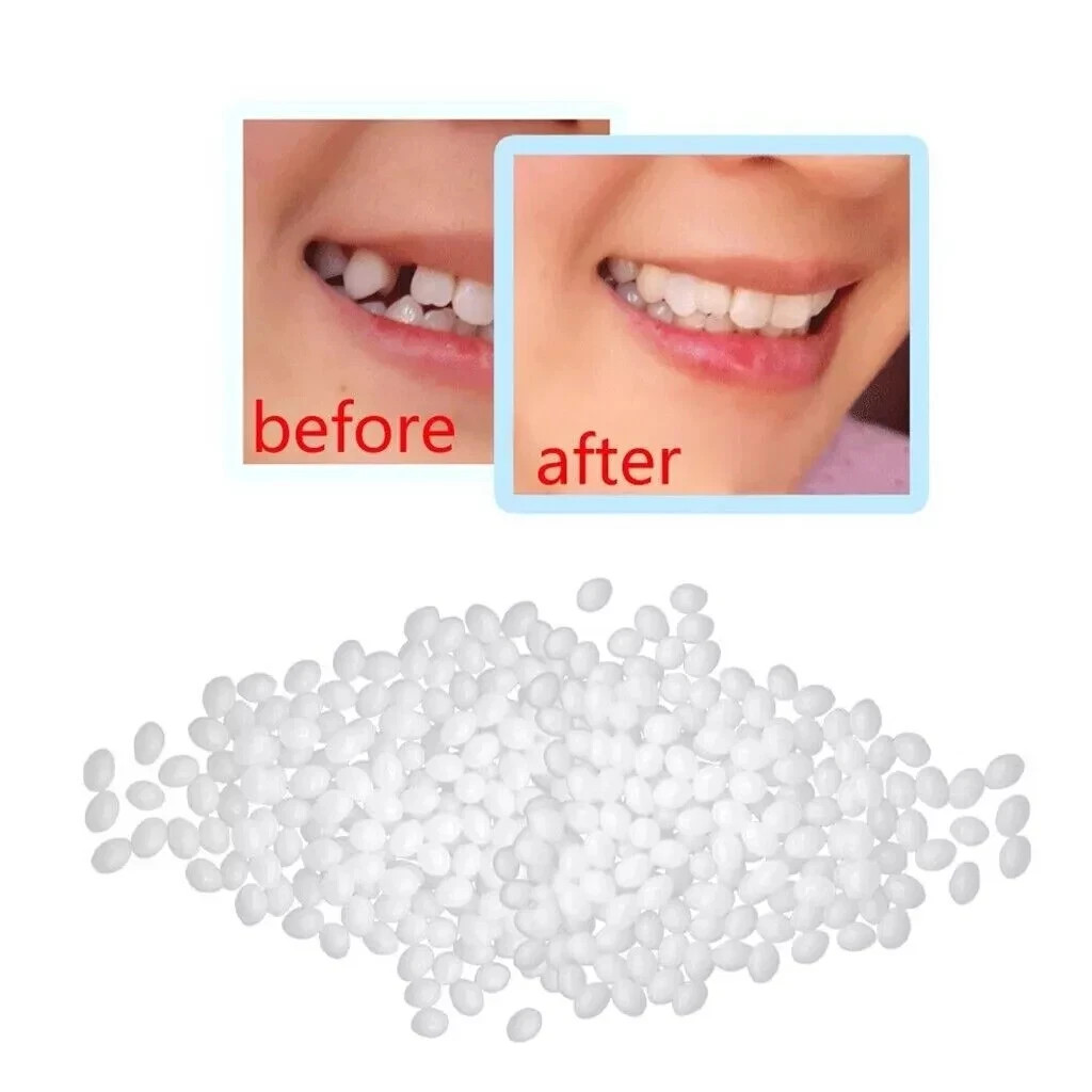 Dental Thermal Beads Replacement Temporary 25g ﻿Tooth Denture False Repair Tool