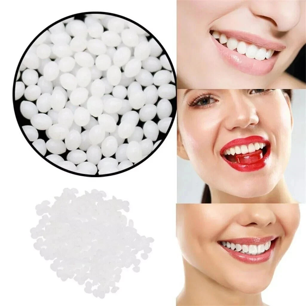 Dental Thermal Beads Replacement Temporary 25g ﻿Tooth Denture False Repair Tool