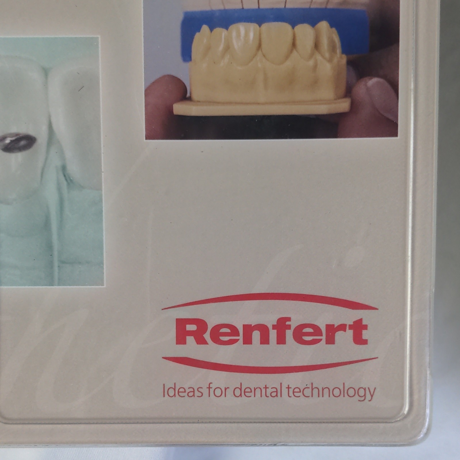 Renfert GEO Aesthetics Wax Veneers Facets Dental Laboratory Kit Set