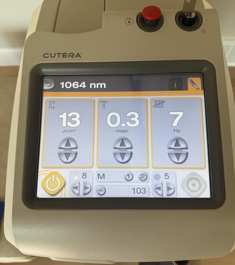 Cutera Excel HR 1064 @ 755 NM laser Hair removal,Lesions,Laser Genesis Warranty