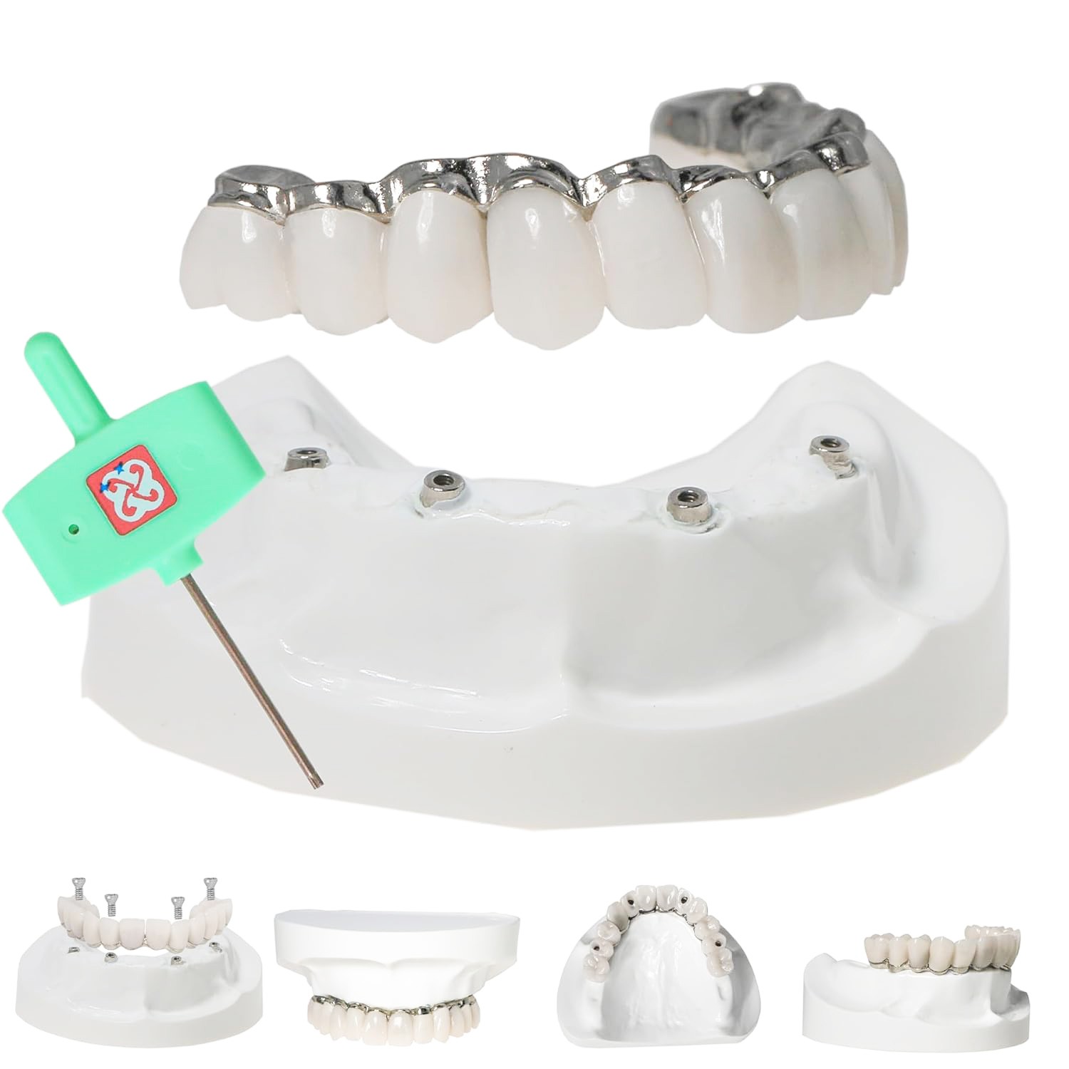 Dental All-on-4 Overdenture Model Upper Jaw Implants Restoration 4 Screws M6023