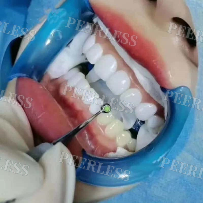 Dental Composite Resin Light Cure Bright White Veneer Foam Pads Hybrid Aesthetic