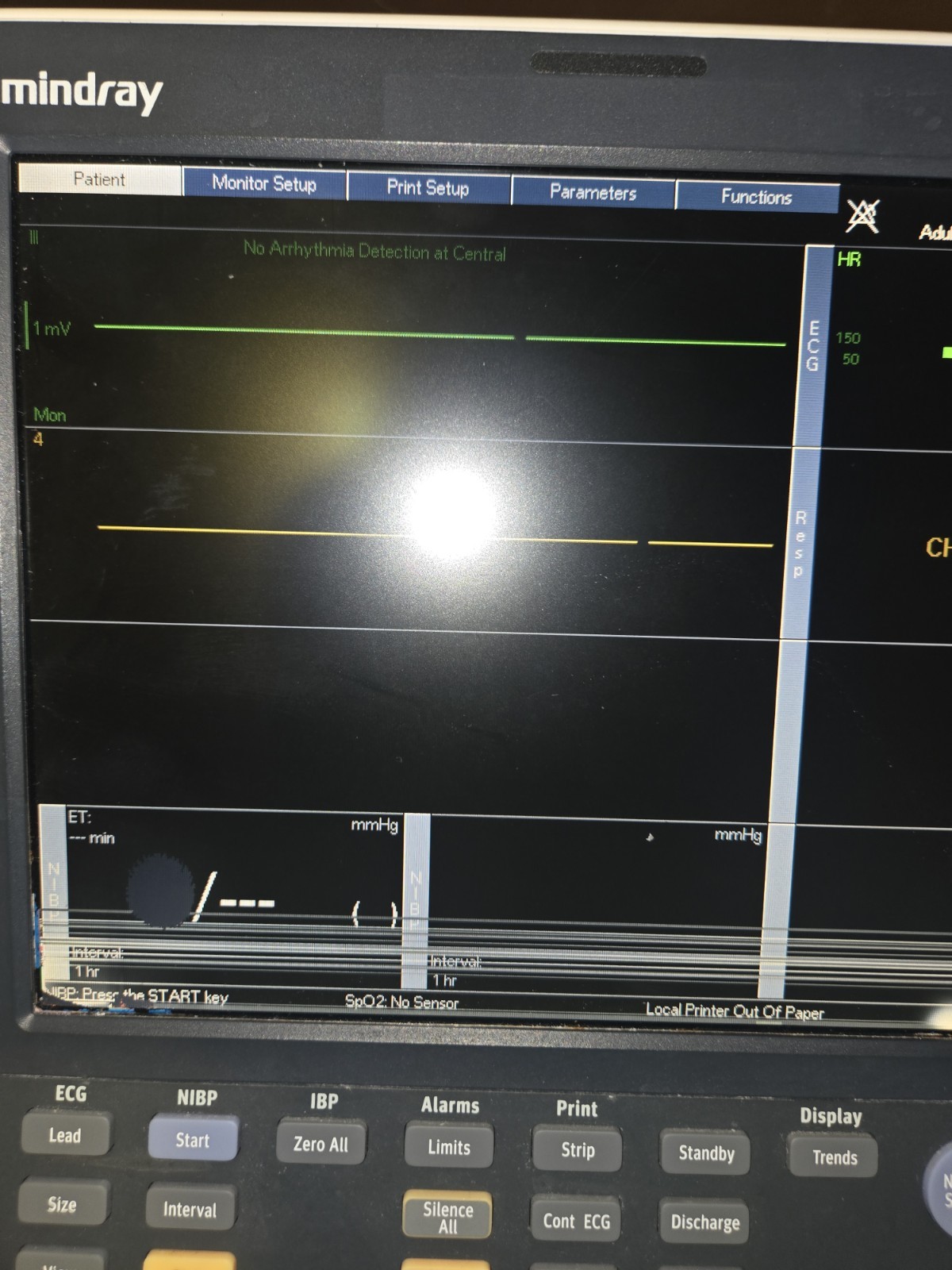 MINDRAY Datascope Passport V Patient Monitor