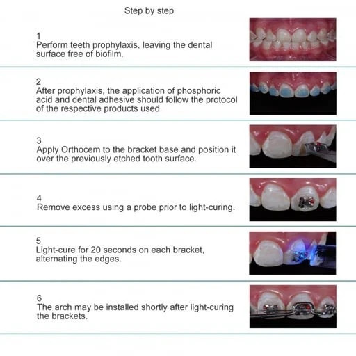 FGM Orthocem Light-Curing Orthodontic Cement for Brackets 4g Syringe