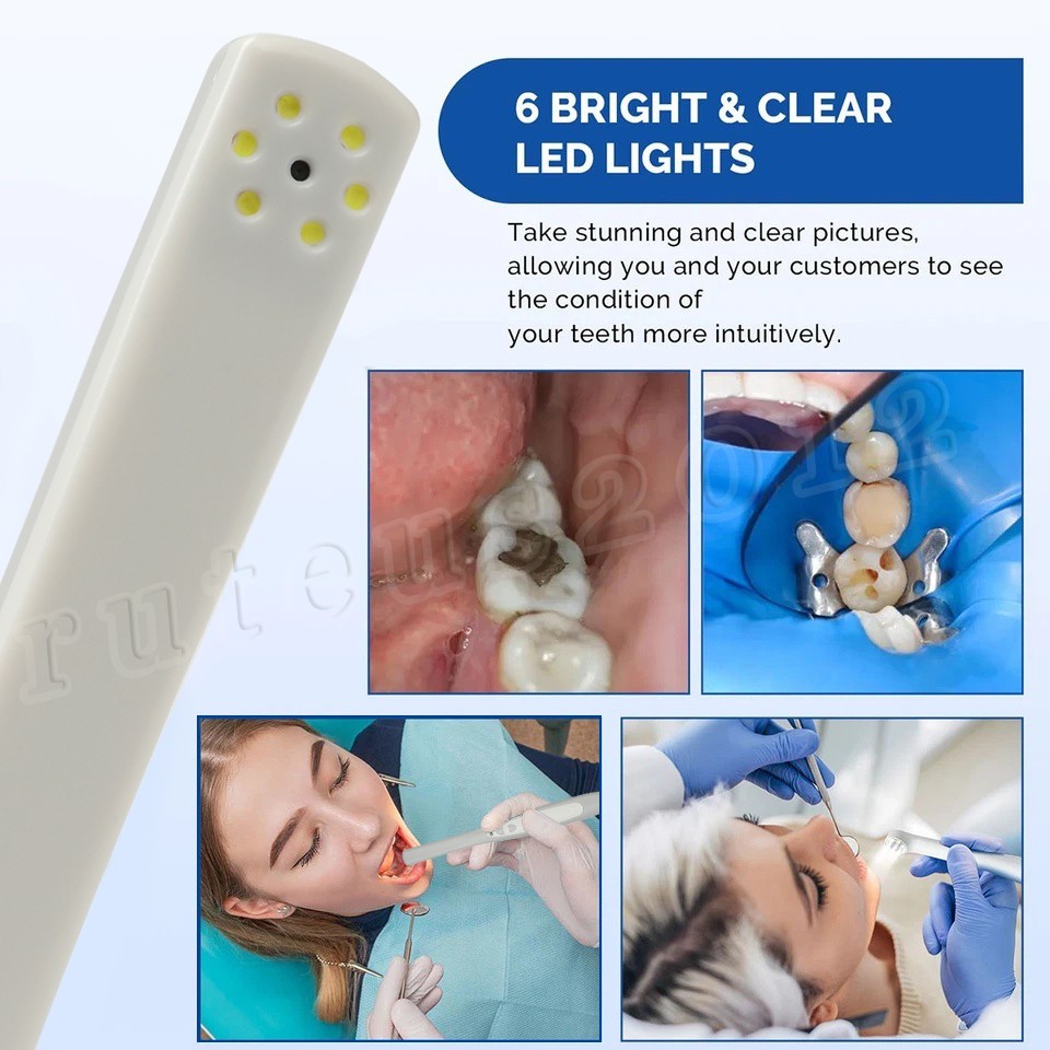MD740 Dental Intraoral Camera USB Digital Imaging Intra Oral
