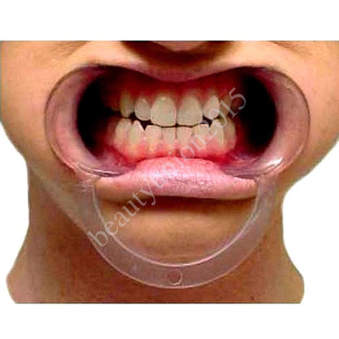 20pc Adult Large Size C-Shape Mouth Opener Lip Dental Cheek Retractors 17 year+