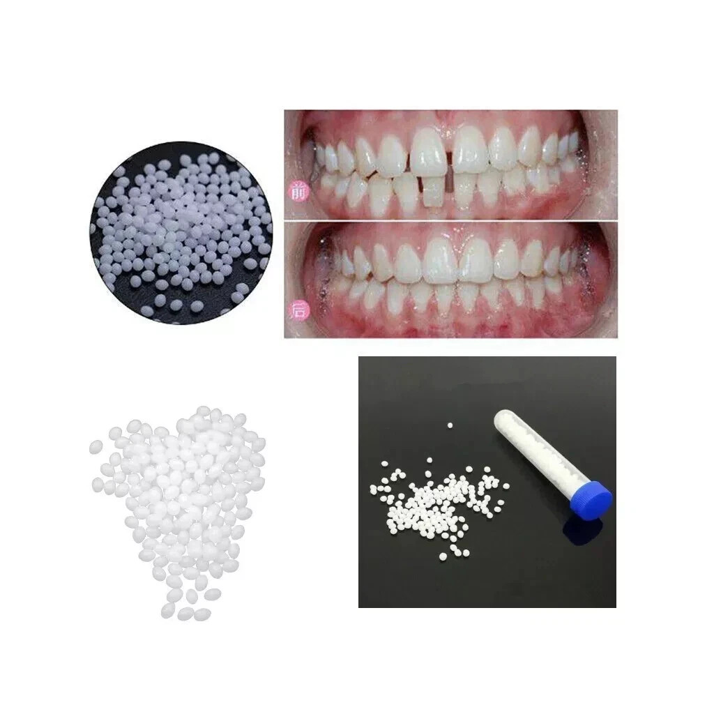 Dental Thermal Beads Replacement Temporary 25g ﻿Tooth Denture False Repair Tool