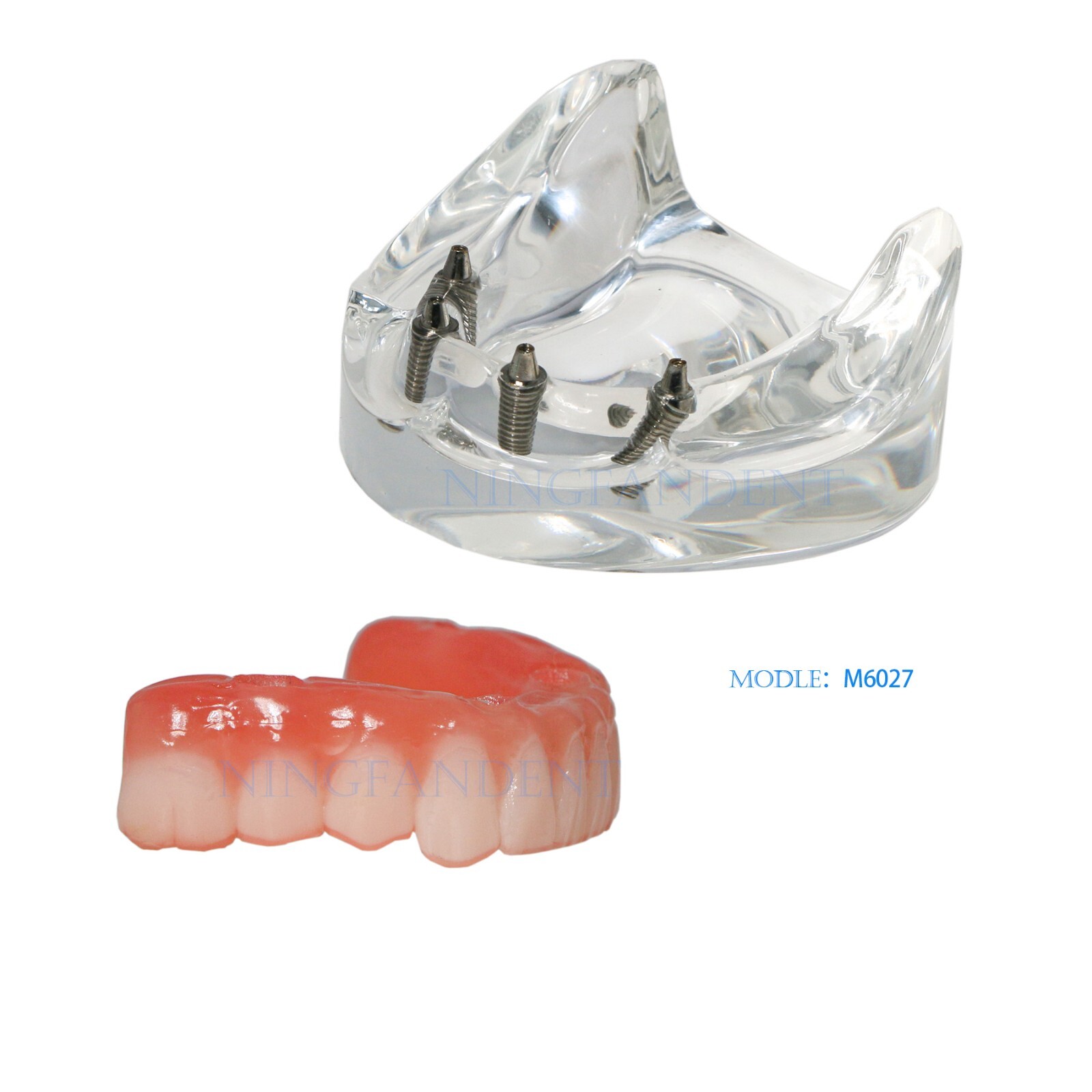 Dental All-on-4 Overdenture Implant Model, Upper/Lower Jaw-Clear,With 4 Screw