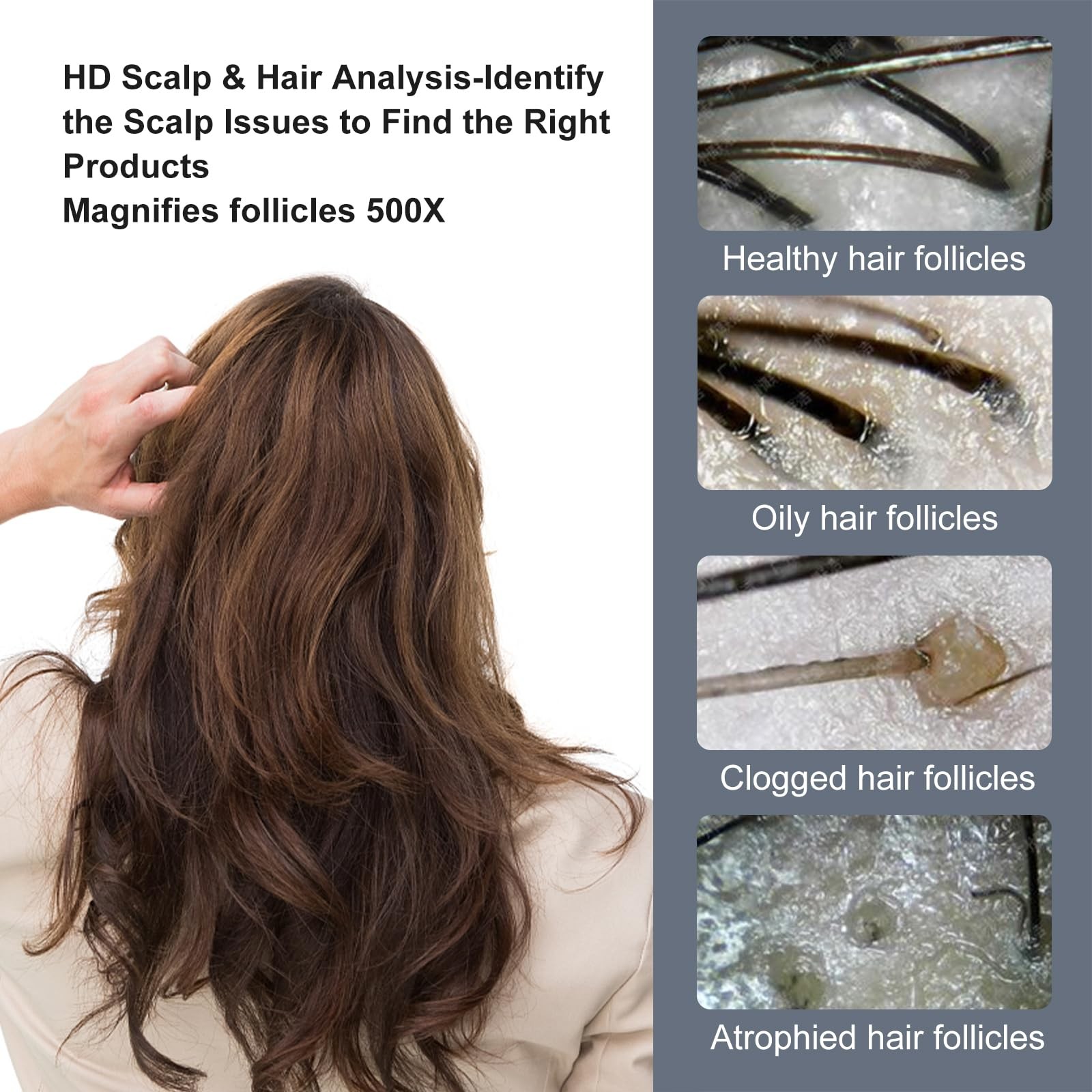 Handheld Dermatoscope, 500X Magnification Skin & Scalp Analyzer for Scalp/Hair