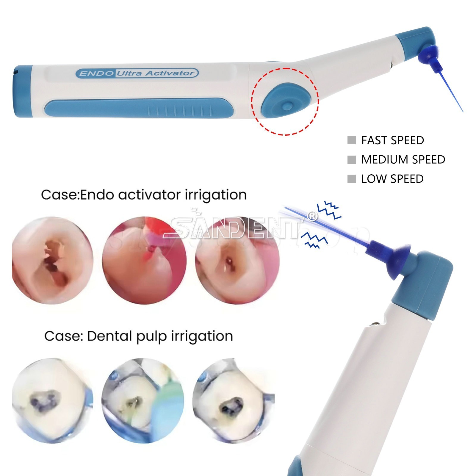 Dental Wireless Ultrasonic Activator Endo Ultra Activator with 150 Tips 3 Colors