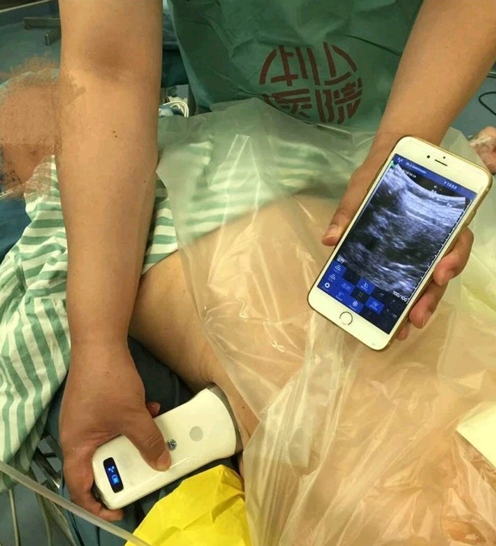 Wireless Convex Ultrasound 3.5-5 MHz Hand Scanner Portable iPad/iOS/Android/Pc