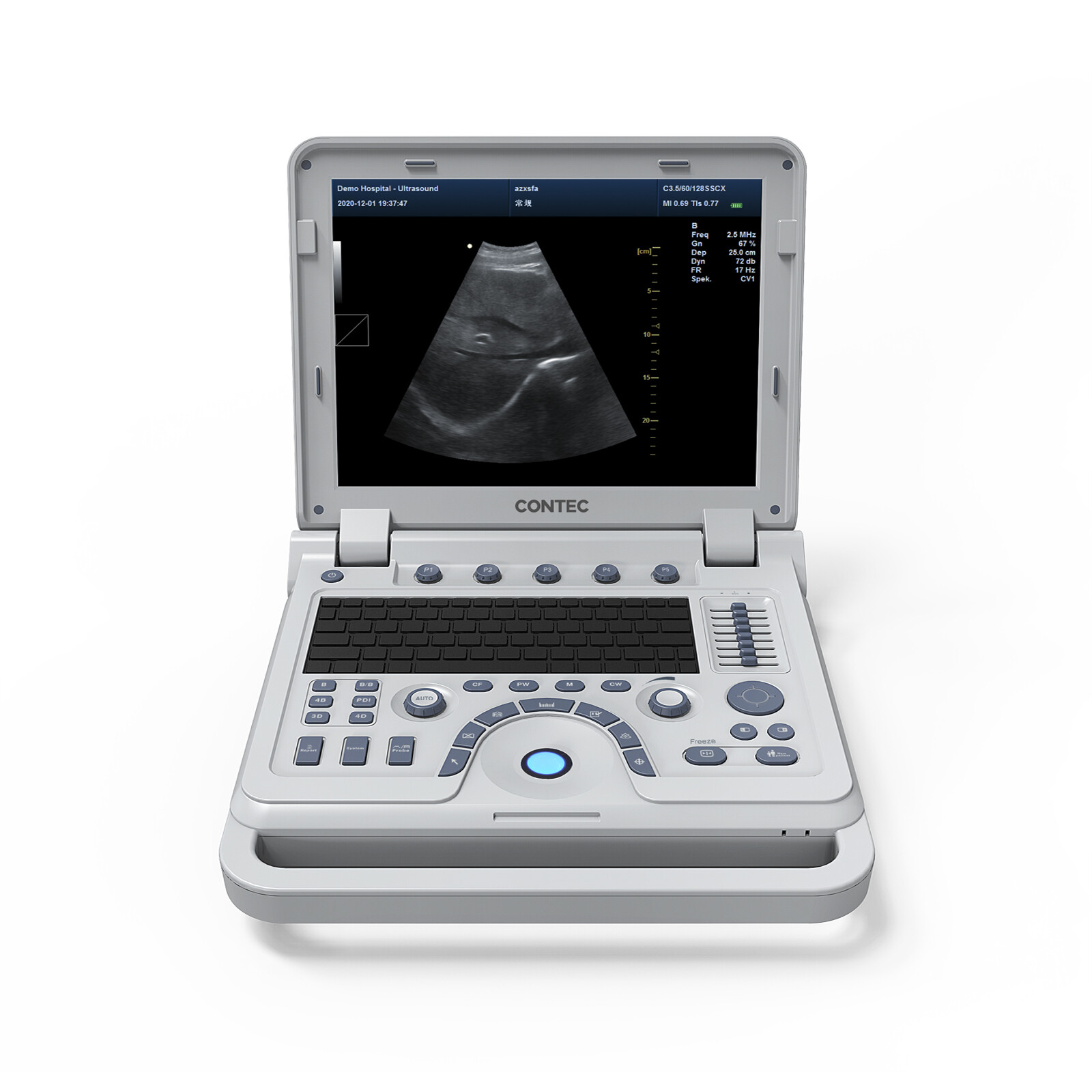 Ultrasonic Diagnostic System abdomen/convex probe CONTEC CMS600P2 PLUS+Free PW