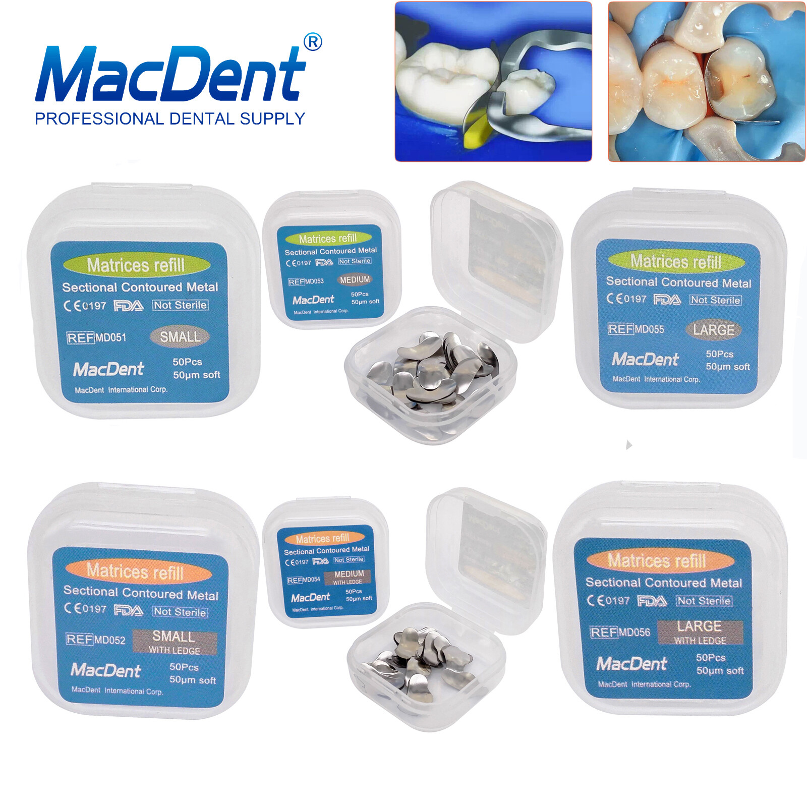 50 Pcs Dental Matrix Sectional Contoured Metal Matrices Bands S/M/L Sizes 35μm