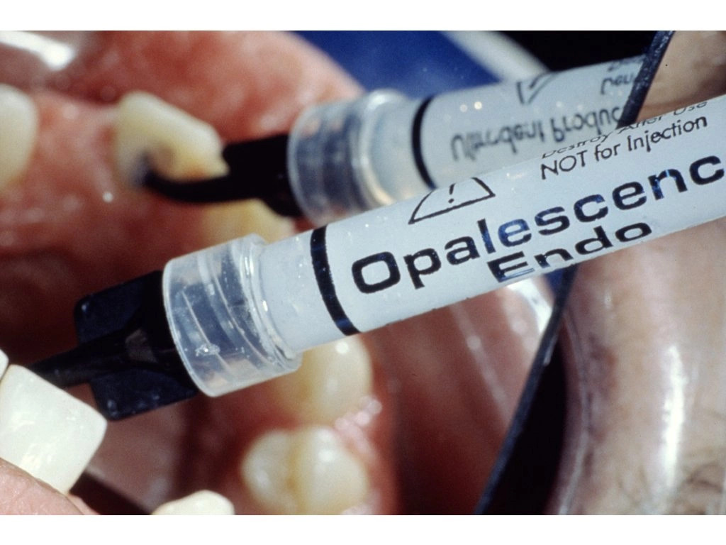 Ultradent Opalescence Endo Endodontic System Kit De Blanqueamiento Endodóntico