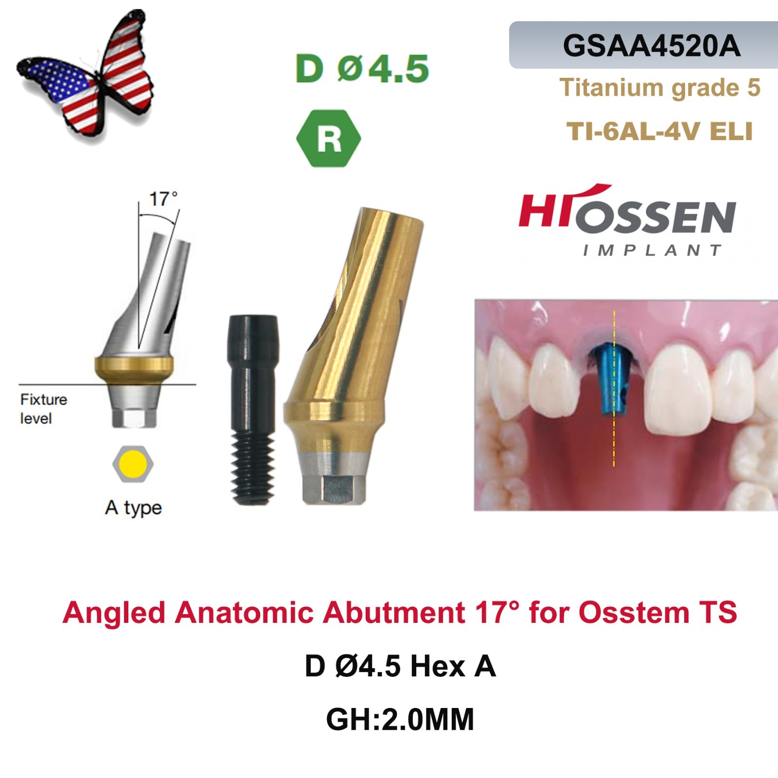 US 17° Angulated Abutment Regular Hex A/B Type For Osstem TS Regular Platform Ti