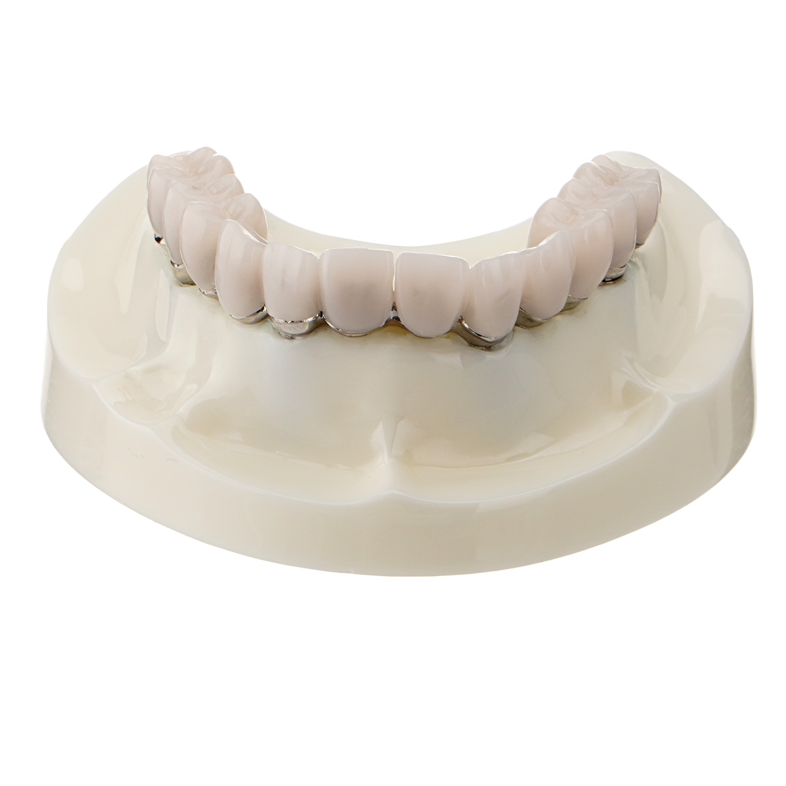 Dental All-on-4 Overdenture Model Upper Jaw Implants Restoration 4 Screws M6023