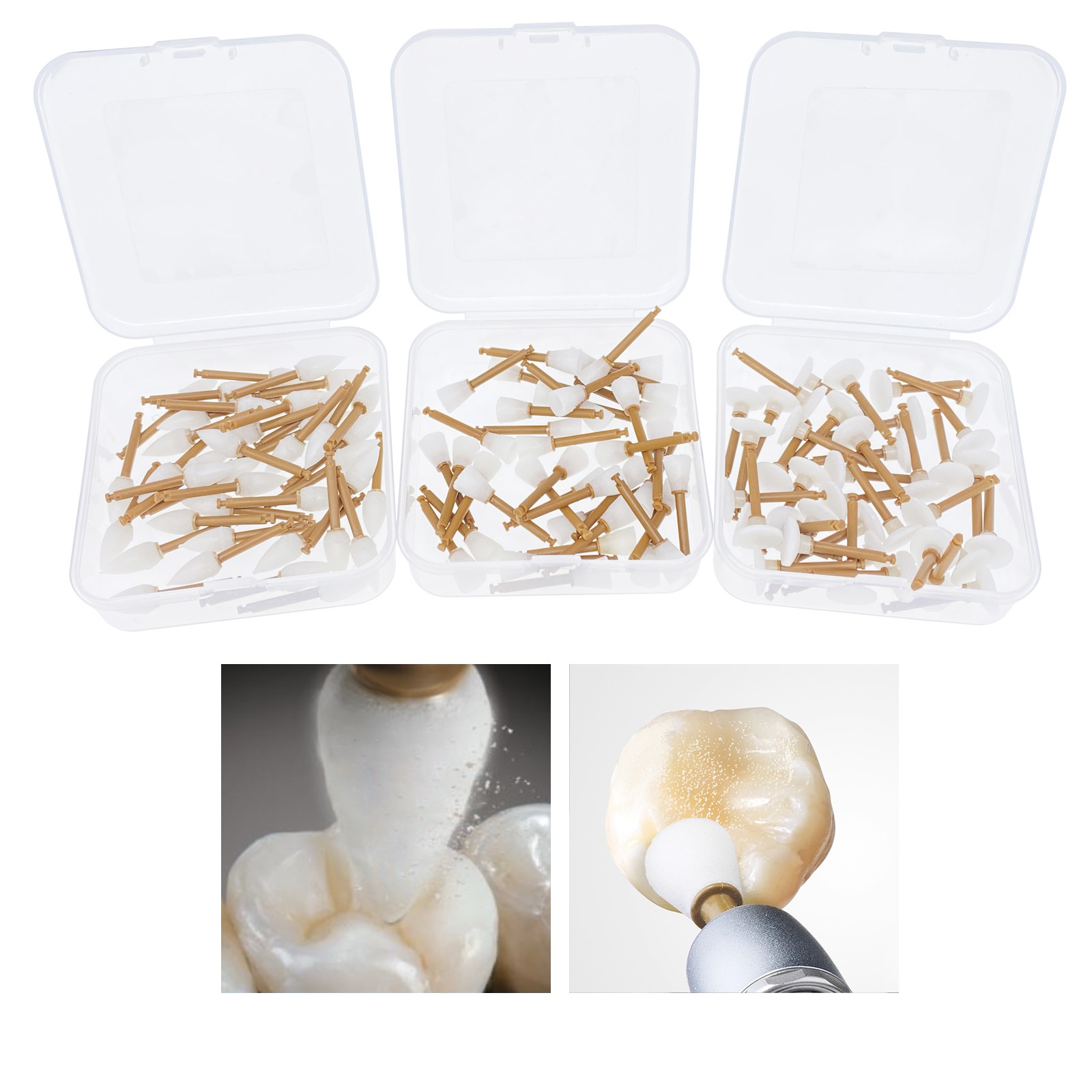 ENHANCE Style Dental Composite Polishing Finishing Finishers RA Cups/Points/Disc