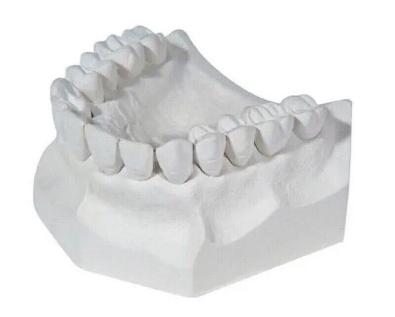 DENTAL LAB PLASTER STONE WHITE TYPE II REGULAR SET 5 Lbs