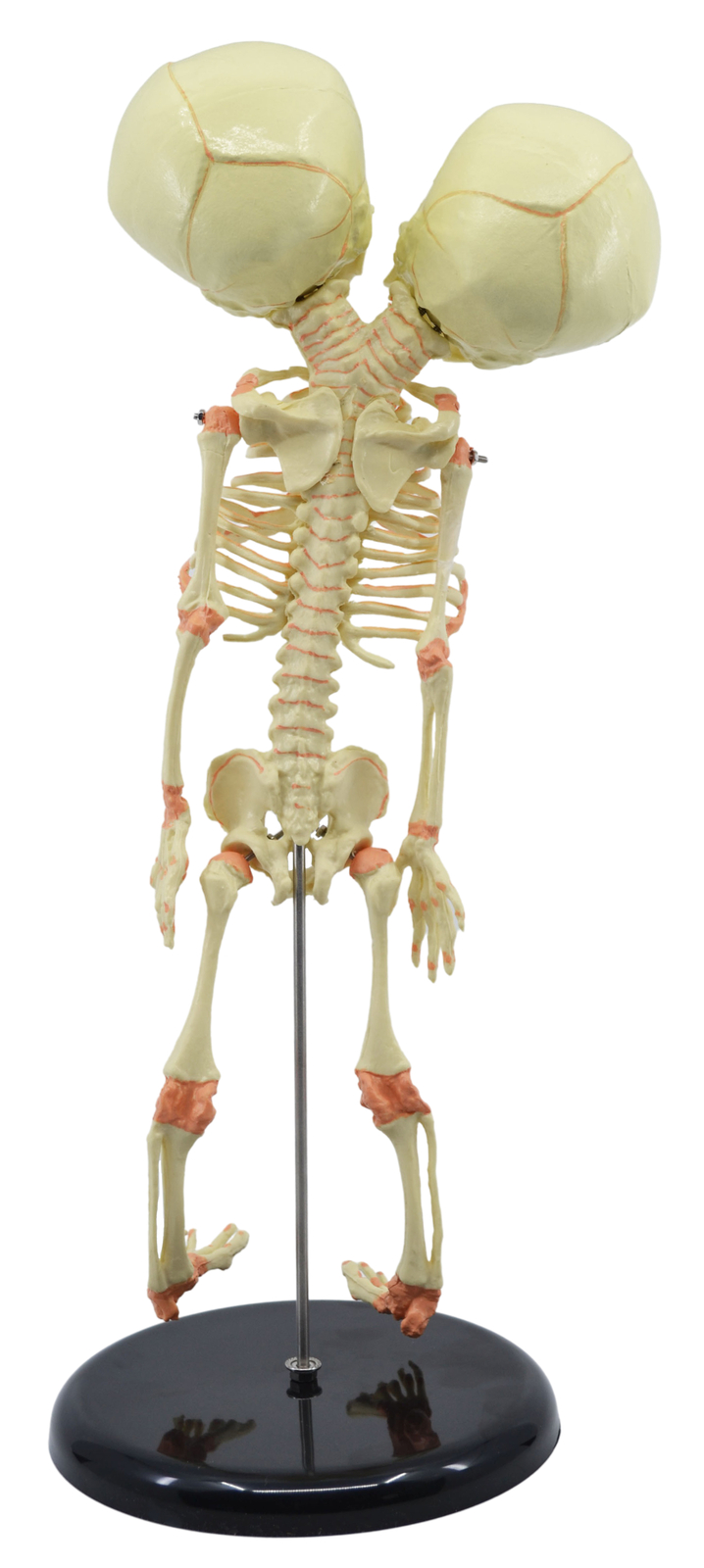 Infant Fetus Skeleton Model, Mini Size – Twin, Conjoined Skull – Eisco Labs