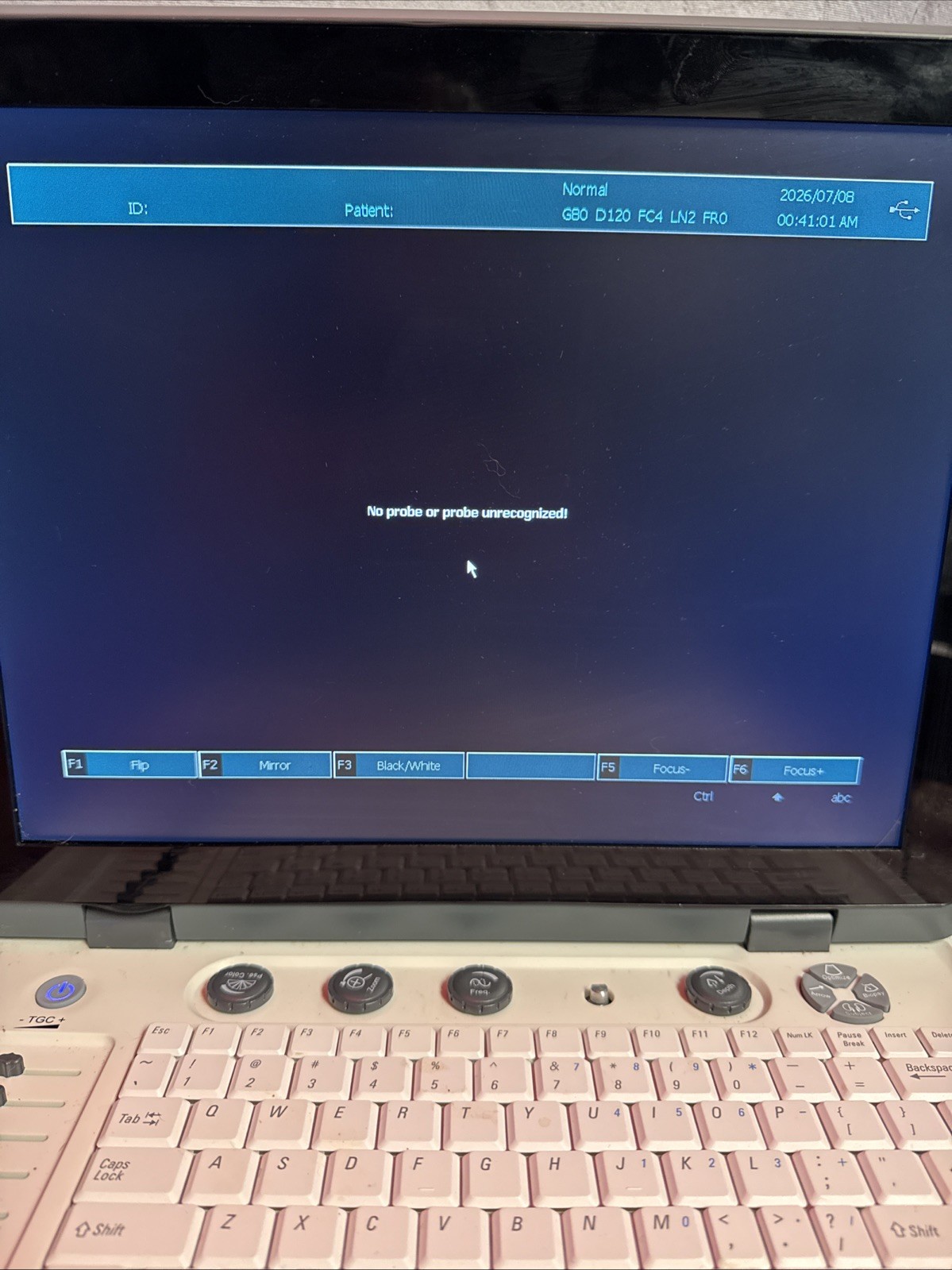 15″ Portable Laptop Ultrasound Scanner Machine Diagnostics Ultrasound System