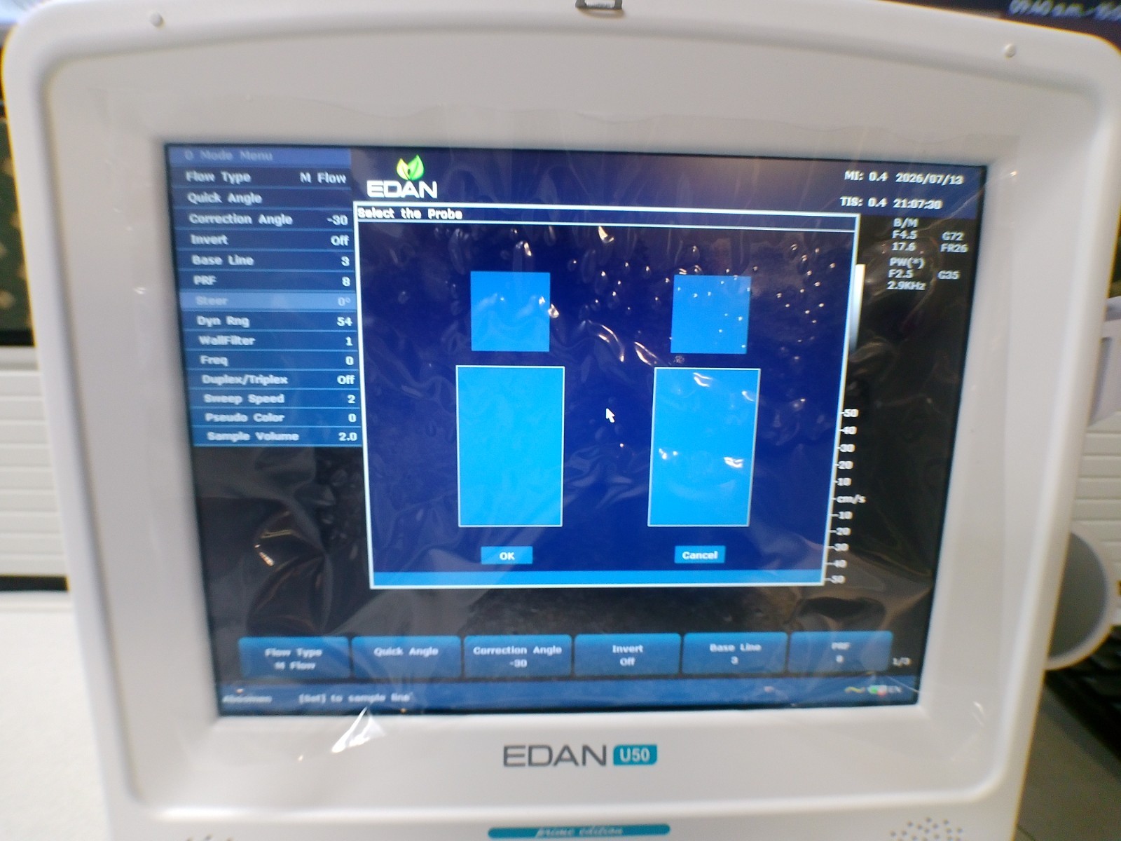 Edan U50 prime edition Diagnostic Ultrasound