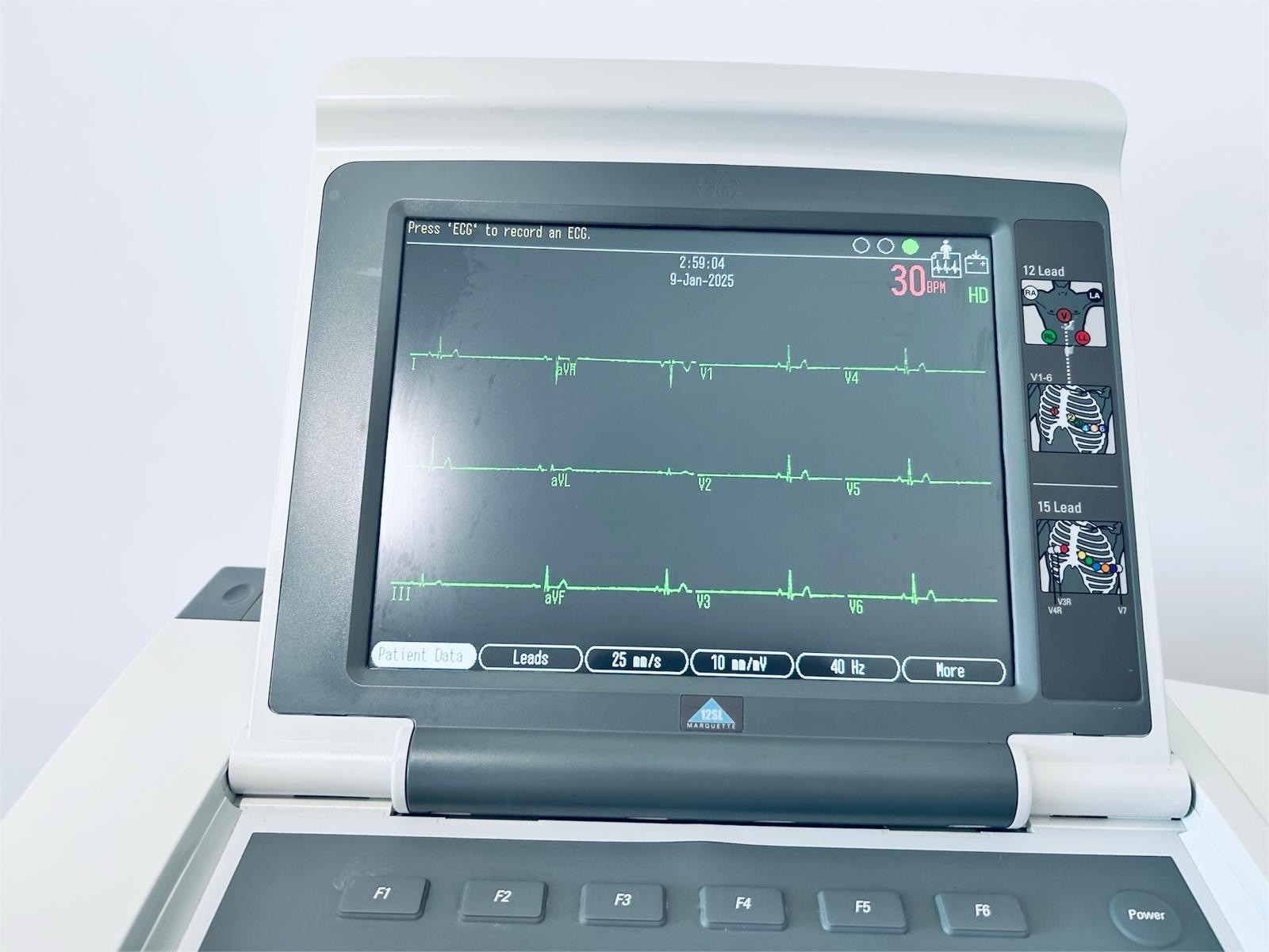 GE Healthcare MAC 5500 HD ECG with CAM Module