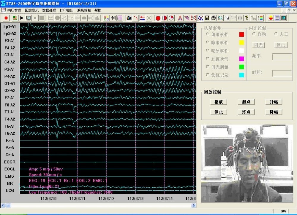 KT88-2400 24 Channel EEG Brain Electrical Activity Mapping System Software