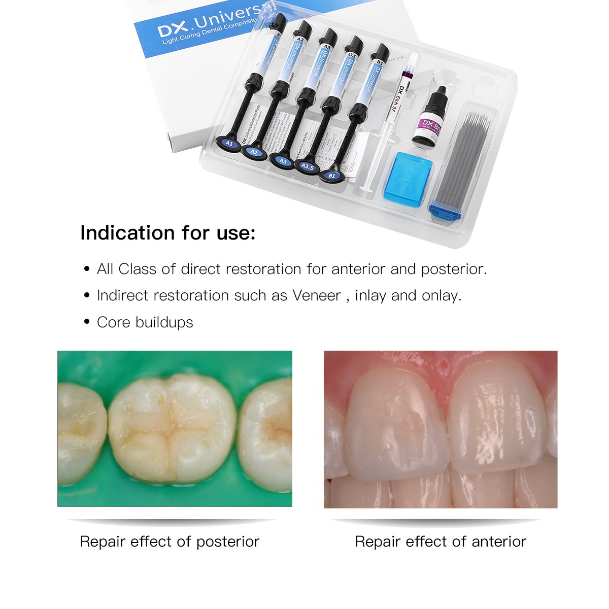 30Pcs Plastic Atachments For Dental Painless Oral Local Anesthesia