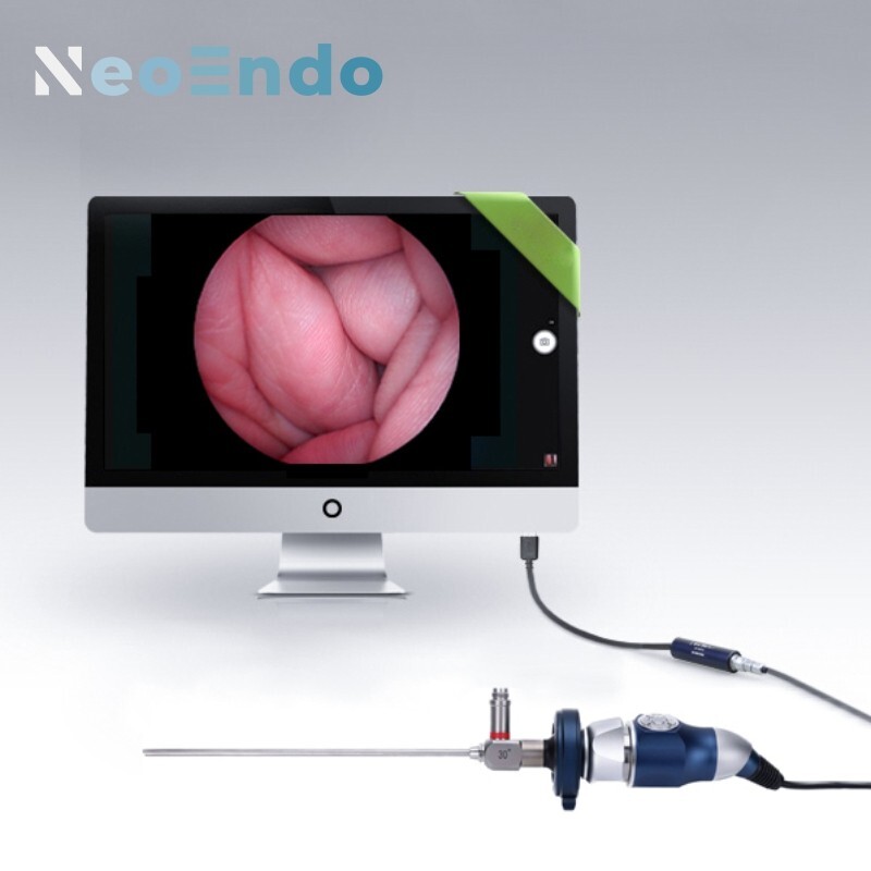 Portable Full HD 1080P Medical Endoscope Camera for ENT Surgery & Inspection