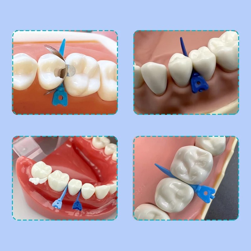 Dental Tulwar Wedges Sectional Matrix System Disposable Plastic Diastema Wedges