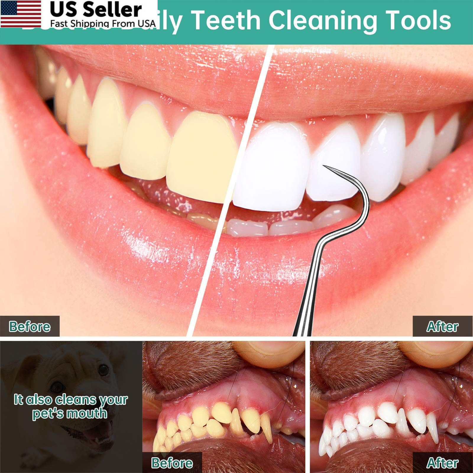 Professional Dental Scraper Tool Stainless Steel Dentist Pick Teeth Cleaner USA