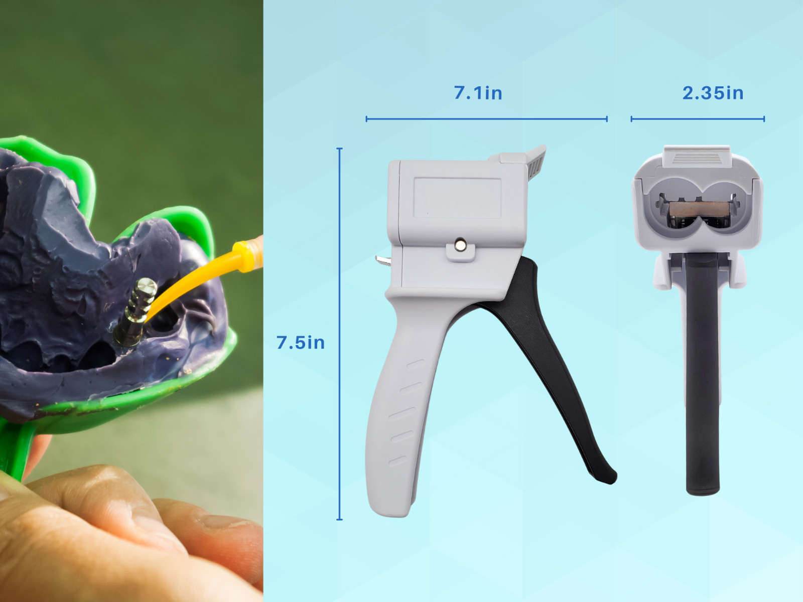 Dispenser Gun Dental 50ml Dispensing Gun Kit 1:1/1:2 fits Most Sizes by ARTMAN