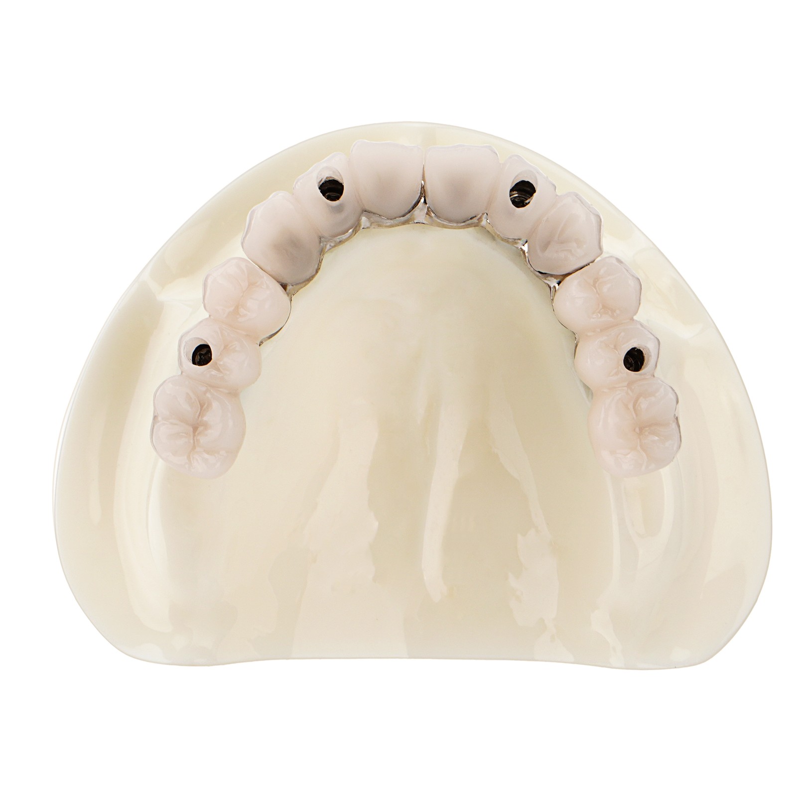 Dental All-on-4 Overdenture Model Upper Jaw Implants Restoration 4 Screws M6023