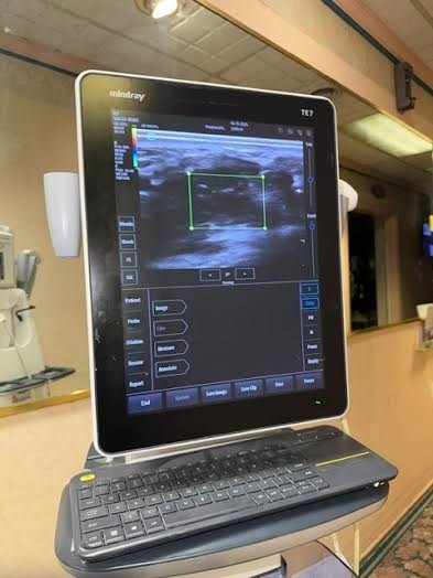 MINDRAY TE 7 ultrasound with two probes